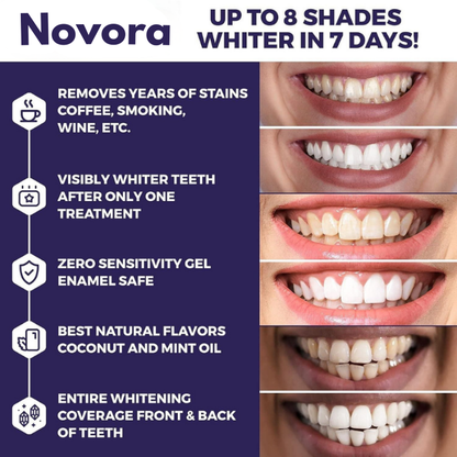 Neol Purple Teeth Whitening Strips™