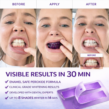 Neol Purple Teeth Whitening Strips™